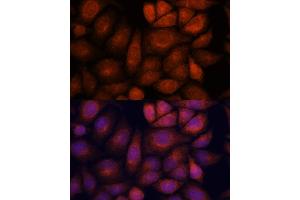 Immunofluorescence analysis of HeLa cells using KIF13A antibody (ABIN7268122) at dilution of 1:100. (KIF13A 抗体  (AA 1300-1600))