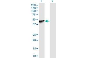 Western Blot analysis of PDCD1LG2 expression in transfected 293T cell line by PDCD1LG2 monoclonal antibody (M06), clone 7D5. (PDCD1LG2 抗体  (AA 22-111))
