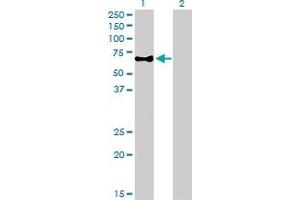 Western Blot analysis of CAMKK1 expression in transfected 293T cell line by CAMKK1 monoclonal antibody (M01A), clone 1F6. (CAMKK1 抗体  (AA 1-520))