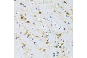 Immunohistochemistry of paraffin-embedded mouse brain using CCT4 antibody (ABIN2561655) at dilution of 1:100 (40x lens). (CCT4 抗体)