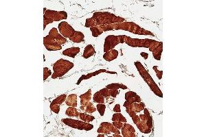 Immunohistochemistry (Paraffin-embedded Sections) (IHC (p)) image for anti-Solute Carrier Family 16 (Monocarboxylic Acid Transporters), Member 3 (SLC16A3) (AA 433-462), (C-Term) antibody (ABIN656331)