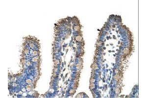 Image no. 1 for anti-rho-Related BTB Domain Containing 1 (RHOBTB1) (C-Term) antibody (ABIN6736347) (RHOBTB1 抗体  (C-Term))