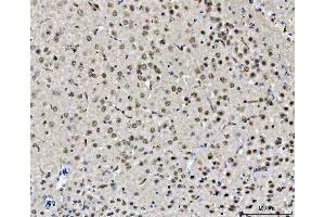 IHC analysis of CHD2 using anti-CHD2 antibody (ABIN5518901). (CHD2 抗体  (AA 1124-1351))