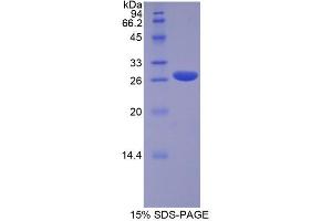 SDS-PAGE analysis of Human RUNX2 Protein. (RUNX2 蛋白)