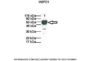 Western Blotting (WB) image for anti-Heat Shock 60kDa Protein 1 (Chaperonin) (HSPD1) (C-Term) antibody (ABIN2792215) (HSPD1 抗体  (C-Term))