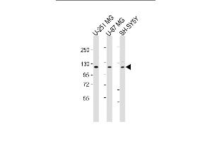All lanes : Anti-SH3PXD2B Antibody (C-Term) at 1:2000 dilution Lane 1: U-251 MG whole cell lysate Lane 2: U-87 MG whole cell lysate Lane 3: SH-SY5Y whole cell lysate Lysates/proteins at 20 μg per lane. (SH3PXD2B 抗体  (AA 596-628))