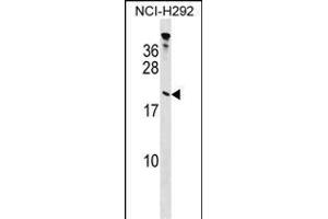 TP Antibody (Center) (ABIN1538440 and ABIN2848728) western blot analysis in NCI- cell line lysates (35 μg/lane). (Tppp 抗体  (AA 47-75))