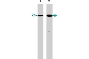 Western blot analysis of HCT-116 src transformed cells (20 mg/lane) serum starved overnight (lane 1) or treated with pervanadate (1 mM) for 30 min (lane 2). (CTNNB1 抗体  (N-Term))