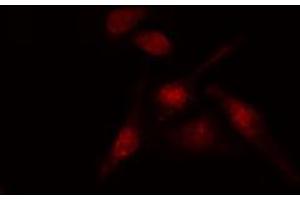 ABIN6274188 staining HT29 cells by IF/ICC. (AFT1 抗体  (Internal Region))