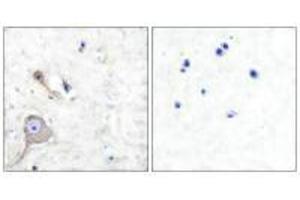 Immunohistochemical analysis of paraffin-embedded human brain tissue using S100 A1 antibody. (S1A1 抗体)