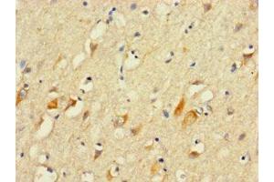 Immunohistochemistry of paraffin-embedded human brain tissue using ABIN7156163 at dilution of 1:100