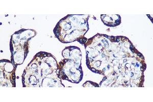 Immunohistochemistry of paraffin-embedded Human placenta using YTHDF2 Polyclonal Antibody at dilution of 1:100 (40x lens). (YTHDF2 抗体)