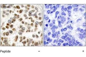 Image no. 1 for anti-Breast Cancer 1 (BRCA1) (Ser1423) antibody (ABIN197480) (BRCA1 抗体  (Ser1423))