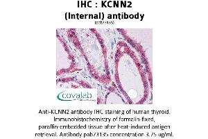Image no. 2 for anti-Potassium Intermediate/small Conductance Calcium-Activated Channel, Subfamily N, Member 2 (KCNN2) (AA 545-557), (Internal Region) antibody (ABIN1736194) (KCNN2 抗体  (Internal Region))