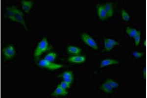 Immunofluorescent analysis of Hela cells using ABIN7143299 at dilution of 1:100 and Alexa Fluor 488-congugated AffiniPure Goat Anti-Rabbit IgG(H+L) (ADORA1 抗体  (AA 202-235))