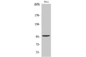 Western Blotting (WB) image for anti-Checkpoint Kinase 2 (CHEK2) (pThr68) antibody (ABIN5961583) (CHEK2 抗体  (pThr68))