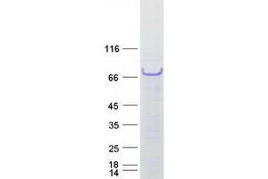 Western Blotting (WB) image for Aspartate beta-Hydroxylase (ASPH) (Transcript Variant 3) protein (Myc-DYKDDDDK Tag) (ABIN2714999)
