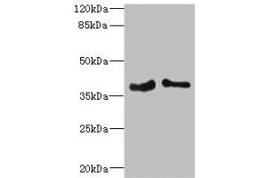 Western blot All lanes: PHF11 antibody at 4. (PHF11 抗体  (AA 1-292))