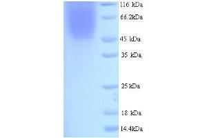 SDS-PAGE (SDS) image for Indoleamine 2,3-Dioxygenase 1 (IDO1) (AA 1-403), (full length) protein (His tag) (ABIN5713520)