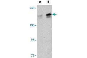 Western blot analysis of PALB2 in SK-N-SH cell lysate with PALB2 polyclonal antibody  at (A) 1 and (B) 2 ug/mL . (PALB2 抗体  (C-Term))