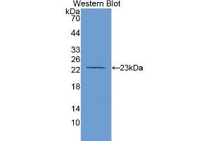 Detection of Recombinant MMP12, Rat using Polyclonal Antibody to Matrix Metalloproteinase 12 (MMP12) (MMP12 抗体  (AA 100-286))