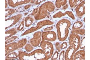 Formalin-fixed, paraffin-embedded human Kidney stained with MTAP Recombinant Rabbit Monoclonal Antibody (MTAP/3137R). (Recombinant MTAP 抗体  (AA 97-196))
