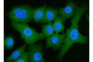 IF analysis of ACLY using anti-ACLY antibody (ABIN4886416). (ACLY 抗体  (AA 1-180))