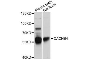 Western blot analysis of extracts of various cell lines, using CACNB4 antibody (ABIN5996096) at 1/1000 dilution. (CACNB4 抗体)