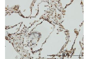 Immunoperoxidase of monoclonal antibody to BIK on formalin-fixed paraffin-embedded human lung. (BIK 抗体  (AA 37-136))