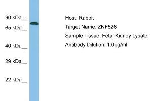 Host: Rabbit Target Name: ZNF526 Sample Type: Fetal Kidney lysates Antibody Dilution: 1. (ZNF526 抗体  (N-Term))