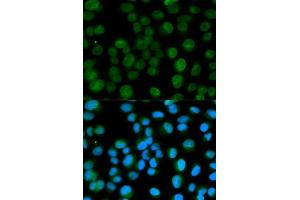 Immunofluorescence analysis of HeLa cells using EMD antibody. (Emerin 抗体  (AA 1-220))