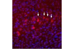 Immunohistochemistry (IHC) image for anti-Glutamate Receptor, Ionotropic, N-Methyl D-Aspartate 3B (GRIN3B) (AA 363-376), (Extracellular) antibody (ABIN7043234)