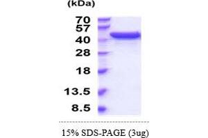 SDS-PAGE (SDS) image for UDP-Glucose 6-Dehydrogenase (UGDH) (AA 1-493) (Active) protein (His tag) (ABIN5855069) (UGDH Protein (AA 1-493) (His tag))