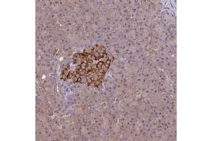 Immunohistochemical staining of human pancreas with ARHGAP19 polyclonal antibody  shows strong cytoplasmic positivity in islets of Langerhans. (ARHGAP19 抗体)