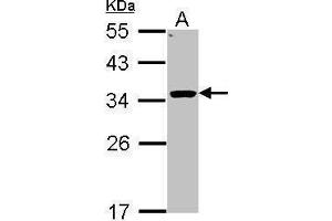WB Image Sample (30 ug of whole cell lysate) A: Hep G2 , 12% SDS PAGE antibody diluted at 1:1000 (HSD11B1 抗体  (C-Term))