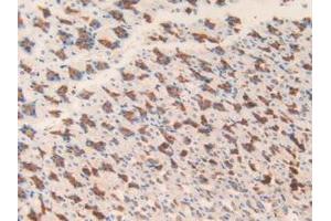 Immunohistochemistry (IHC) image for anti-Microsomal Glutathione S-Transferase 1 (MGST1) (AA 8-155) antibody (ABIN7432178)