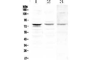Western blot analysis of PLK2 using anti-PLK2 antibody . (PLK2 抗体  (AA 94-188))