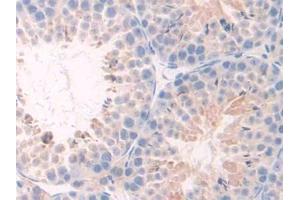 IHC-P analysis of Mouse Testis Tissue, with DAB staining. (TNFRSF1A 抗体  (AA 239-433))