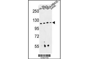 Western blot analysis of RPGRIP1 Antibody in HL-60, K562, MDA-MB435, Jurkat cell line lysates (35ug/lane) (RPGRIP1 抗体  (AA 530-557))