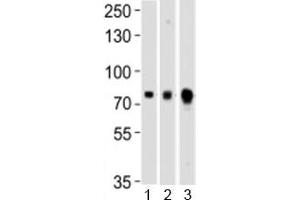 Western blot testing of Melk antibody at 1:1000 dilution and mouse 1) ovary, 2) spleen and 3) testis lysate (MELK 抗体  (C-Term))