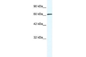 ZNF258 antibody used at 0. (ZMYM6 抗体  (Middle Region))