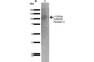 Western Blot analysis of Rat Brain Membrane showing detection of ~105 kDa GABA B Receptor 2 protein using Mouse Anti-GABA B Receptor 2 Monoclonal Antibody, Clone S81-2 . (GABBR2 抗体  (AA 861-912) (Atto 390))