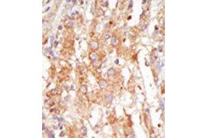 Image no. 2 for anti-Mitogen-Activated Protein Kinase Kinase Kinase 6 (MAP3K6) (C-Term) antibody (ABIN360297) (MAP3K6 抗体  (C-Term))