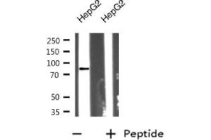 Western blot analysis on HepG2 cell lysate using RHBT2 Antibody (RHOBTB2 抗体)