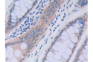 Used in DAB staining on fromalin fixed paraffin- embedded liver tissue (RNASE13 抗体  (AA 20-156))