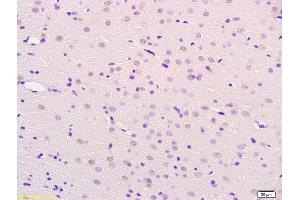 Formalin-fixed and paraffin embedded rat brain labeled with Anti-BCHE Polyclonal Antibody, Unconjugated (ABIN730603) at 1:200 followed by conjugation to the secondary antibody and DAB staining. (Butyrylcholinesterase 抗体  (AA 505-602))