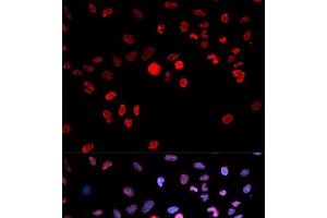 Immunofluorescence analysis of MCF-7 cells using Phospho-CREB1(S133) Polyclonal Antibody (CREB1 抗体  (pSer133))