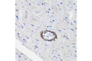Immunohistochemistry of paraffin-embedded rat heart using Filamin A antibody (ABIN7267206) at dilution of 1:100 (40x lens). (Filamin A 抗体  (C-Term))