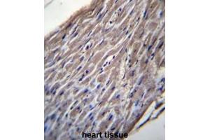 BVES Antibody (C-term) immunohistochemistry analysis in formalin fixed and paraffin embedded human heart tissue followed by peroxidase conjugation of the secondary antibody and DAB staining. (BVES 抗体  (C-Term))