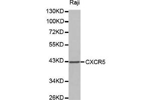 Western blot analysis of extracts of Raji cell lines, using CXCR5 antibody. (CXCR5 抗体)